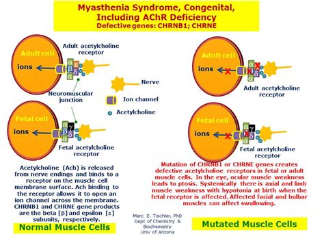 Myasthenic Syndromes Congenital Including Achr Deficiency