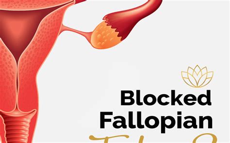 FTR Symptoms And Causes Of Blocked Fallopian Tubes Fibroid
