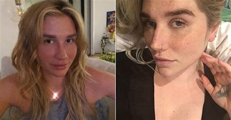 Photos Of Kesha With No Makeup Popsugar Beauty
