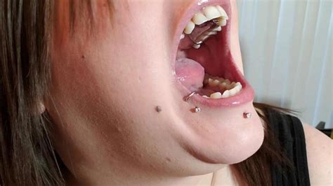 Young Gal Wearing Partial Dentures Porn Videos