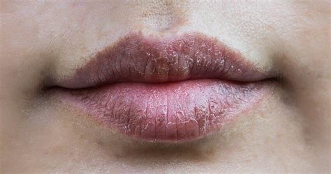 How Is My Lips Telegraph