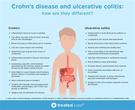 Crohns Disease And Ulcerative Colitis And How They Are Different