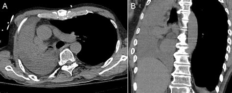 Southwest Journal Of Pulmonary Critical Care And Sleep Imaging