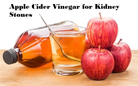 The Best Apple Cider Vinegar Kidney Stones Best Round Up Recipe