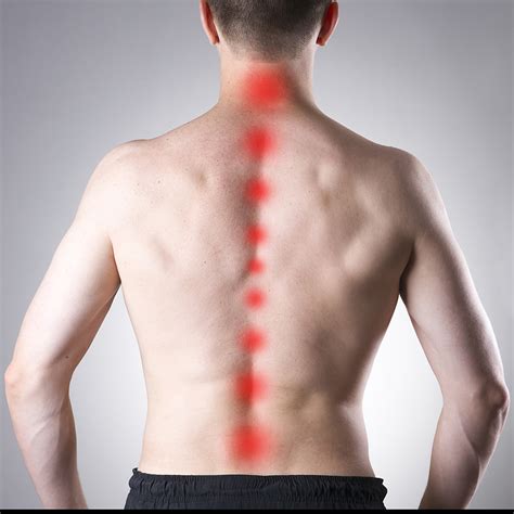 Causes Of Back And Spine Pain William Capicotto Md