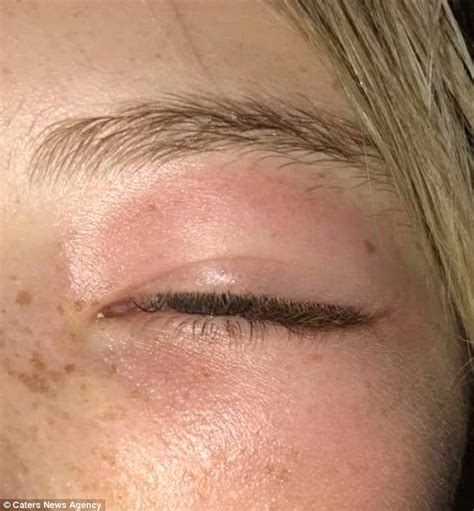 Mum Claims Daughter Was Unable To Open Eye After Using Kmart Mask Daily Mail Online