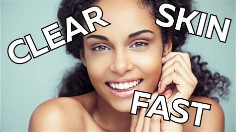 How To Get Clear Skin Fast Naturally Youtube