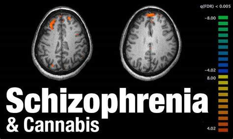 Harvard Study Proves Cannabis Does Not Cause Schizophrenia Cannabis