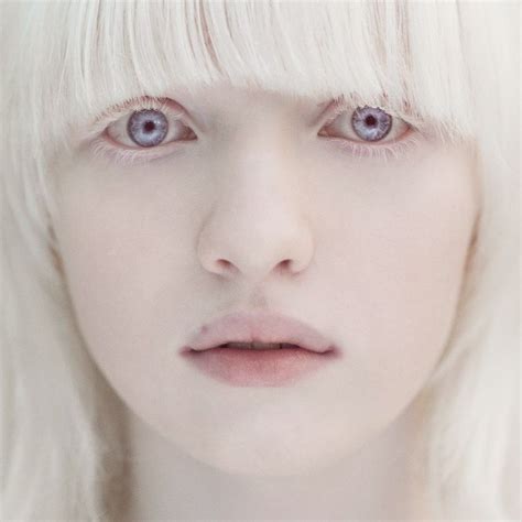 Crystallized Rose Lilac Smokesss Albino Model Wow Shes So Beautiful Her Name Is