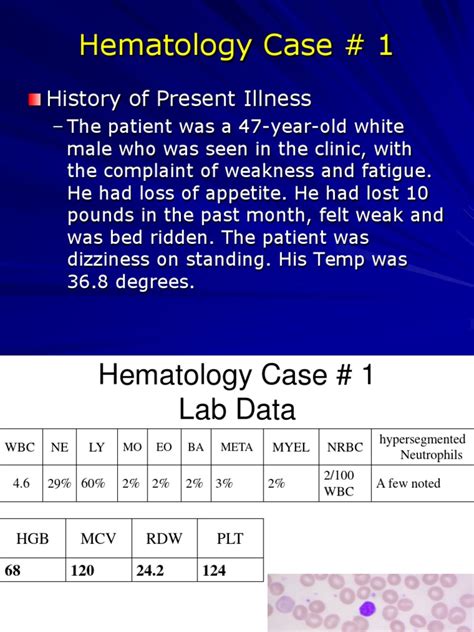 Hematology Cases Pdf Anemia White Blood Cell