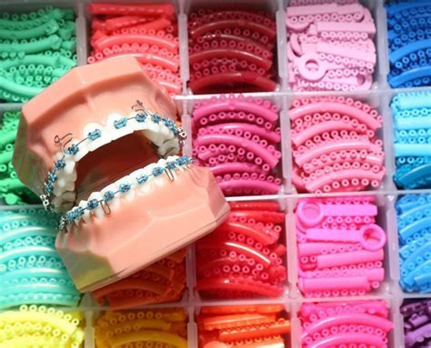 What Color Of Braces Should You Wear Shinagawa Ph