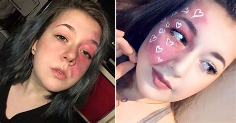 Student Highlights Her Facial Birthmark With Makeup To Encourage Others