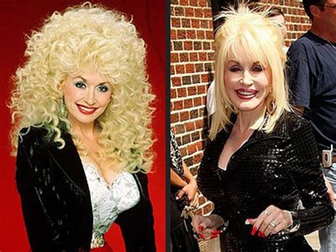 46 Eye Opening Photos Of Celebrities Then And Now Dolly Parton Then