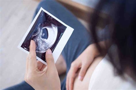 what happens during the 12 week scan in dublin 1 merrion fetal health