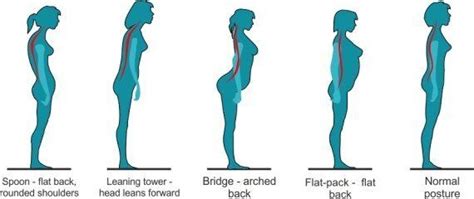 Could Poor Posture Be Causing Your Back Pain This Graphic Reveals If