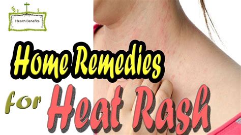 Home Remedies For Heat Rash Treat Heat Rash Prickly At Home Cure