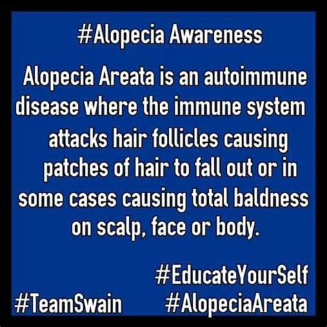 Diseases due to incompatibility of genes. Pin on Alopecia