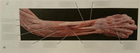 Gross Anatomy Posterior Forearm Cadaver 1 Diagram Quizlet