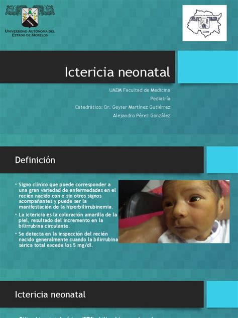 Ictericia Neonatal Pdf Infantes Especialidades Medicas