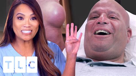 Dr Pimple Popper’s Biggest Cyst Ever “the Standing World Record ” Dr Pimple Popper Youtube