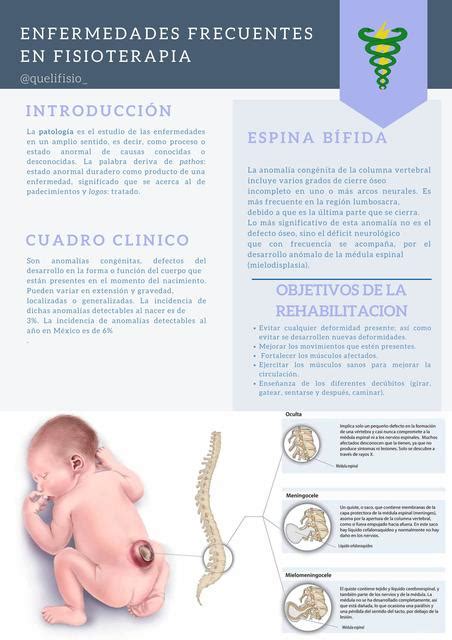 Enfermedades Frecuentes En Fisioterapia Espina Bífida Espina Bífida