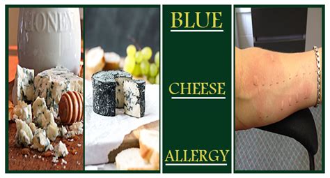 Blue Cheese Allergy Allergy