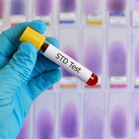 Sexually Transmitted Disease Screening Std Test Yesmaam