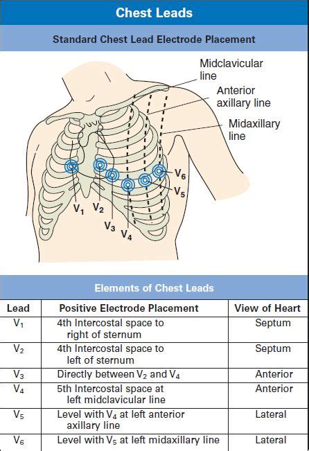 Ekg Lead Placement Chronicles Of The Limited Bandwidth Cma Study