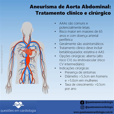 Aneurisma De Aorta Abdominal Tratamento Clínico E Cirúrgico