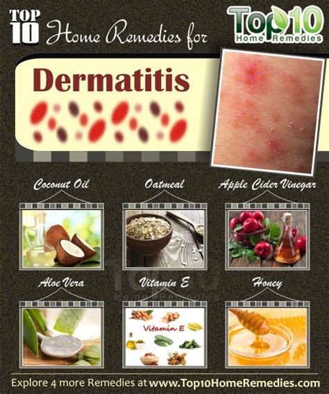 Home Remedies For Dermatitis Top 10 Home Remedies