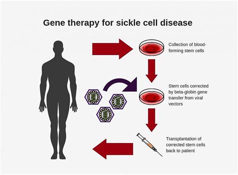 Nih Researchers Create New Viral Vector For Improved Gene Therapy In