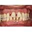 NEW STUDY LINKS GUM DISEASE AND COVID‐19 COMPLICATIONS – Britten Perio