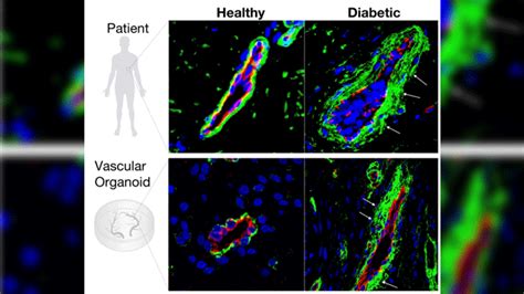 Human Blood Vessels Organoids A Model For Diabetes Research