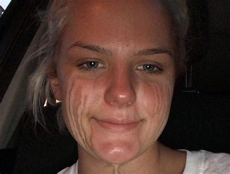 Woman CRIED After Applying Fake Tan And Is Left With Streaks Daily