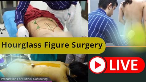 Live Hourglass Figure Surgery Procedure In India How To Reduce Waist And Get An Hourglass