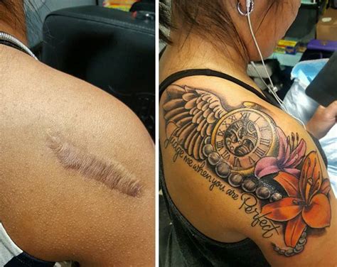 10 Amazing Tattoos That Turn Scars Into Works Of Art Amazing Tattoos