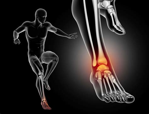 Anterior Ankle Impingement | Pain in Front of Ankle When Walking