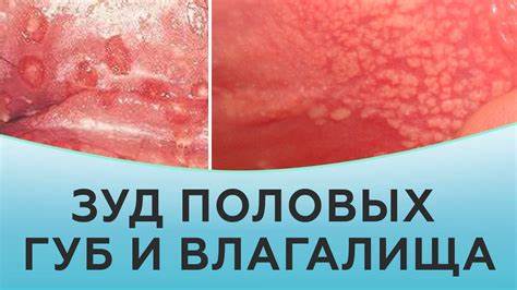 Как похудеть в половых губах