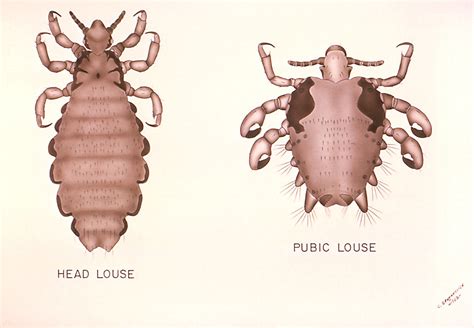 Louse Free Stock Photo Illustrations Comparing The Head Louse With