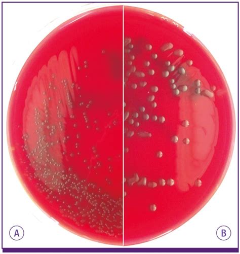 Streptococcus Pneumoniae On Blood Agar Plate