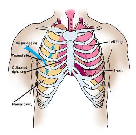 Vestibular anatomy and neurophysiology online course: Anatomy Atlases: Anatomy of First Aid: A Case Study ...