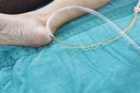Urinary Catheter Uses Types And What To Expect
