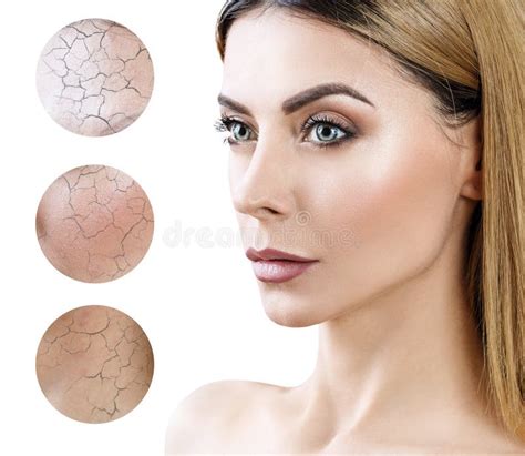 Face Of Adult Woman With Dry Skin In Circles Stock Image Image Of