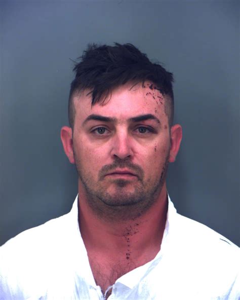 Man, dog die after police say they were hit by drunk driver in the