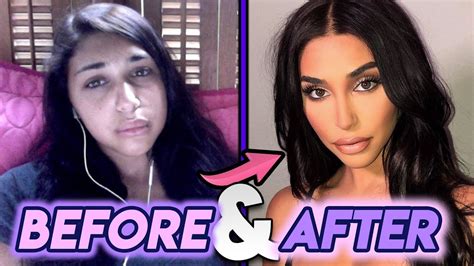 Chantel Jeffries Before And After Transformations Plastic Surgery