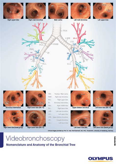Videobronchoscopy Nomenclature And Anatomy Of The Bronchial Tree