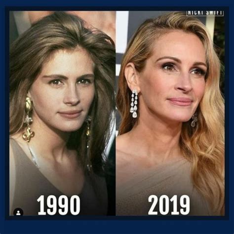 50 Celebrity Plastic Surgeries Before And After Images Page 7 Of 18