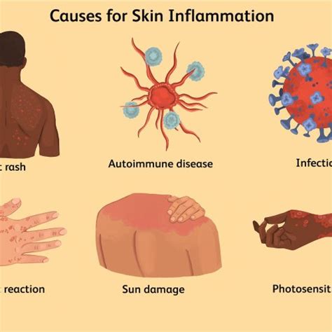 Causes And Treatments For Skin Inflammation Flipboard