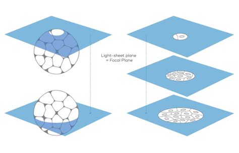 Why Choose A Light Sheet Microscope Bruker