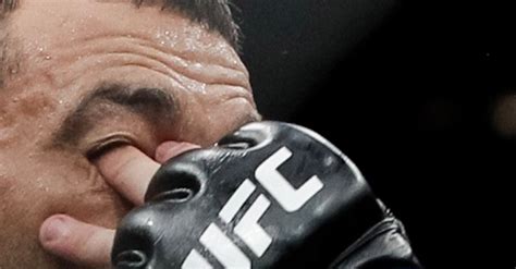 Its Finally Happened Ufc Fighter Suffers Severe Eye Damage From Ufc